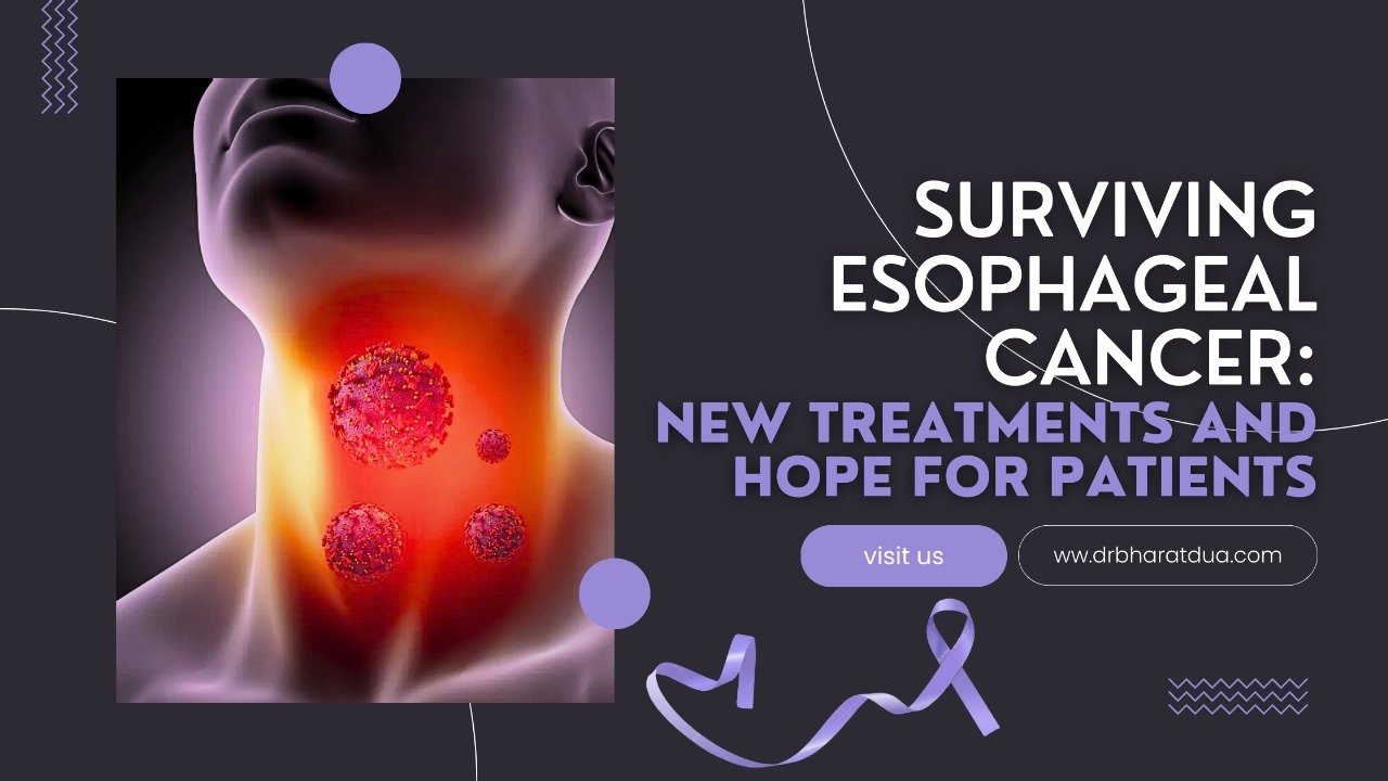 Surviving Esophageal Cancer: New Treatments and Hope for Patients